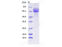 Sino Biological Recombinant Human CD36 Protein (ECD, His Tag), HPLC-verified,