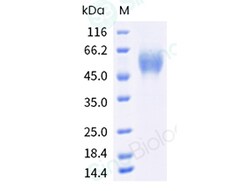 Sino Biological Recombinant Human B7-H4 Protein (ECD, His & AVI Tag), Biotinylated,