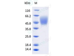 Sino Biological Recombinant Human B7-H4 Protein (ECD, His Tag), HPLC-verified,