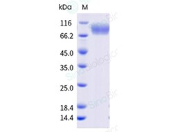 Sino Biological Recombinant Human B7-H4 Protein (ECD, hFc Tag), HPLC-verified,