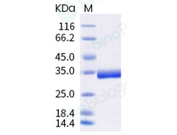 Sino Biological Recombinant Human Erythropoietin R/EPOR Protein (ECD, His