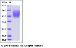 Sino Biological Recombinant Human B7-2/CD86 Protein (His Tag), Amine-Labeled