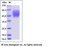 Sino Biological Recombinant Human B7-2/CD86 Protein (His Tag), Amine-Labeled
