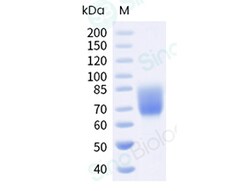 Sino Biological Recombinant Human B7-2/CD86 Protein (ECD, hFc Tag), HPLC-verified,