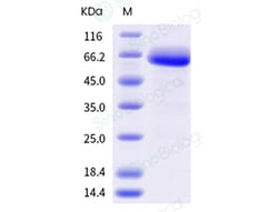 Sino Biological Recombinant Human IL-2R beta/CD122 Protein (ECD, mFc Tag),