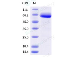 Sino Biological Recombinant Human IL-2R beta/CD122 Protein (ECD, mFc Tag),