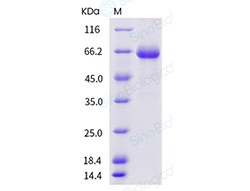 Sino Biological Recombinant Human IL-2R beta/CD122 Protein (ECD, hFc Tag),