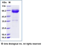 Sino Biological Recombinant Human EpCAM/TROP1 Protein (ECD, hFc & AVI Tag),