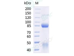 Sino Biological Recombinant Human c-MET/HGFR Protein (ECD, His & AVI Tag),