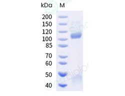 Sino Biological Recombinant Human c-MET/HGFR Protein (ECD, hFc Tag), Quantity: