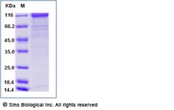 Sino Biological Recombinant Human Angiopoietin-2/ANGPT2 Protein (mFc Tag),
