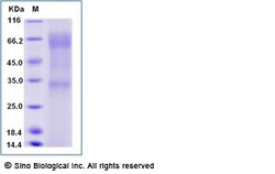 Sino Biological Recombinant Human Angiopoietin-2/ANGPT2 Protein (His Tag),