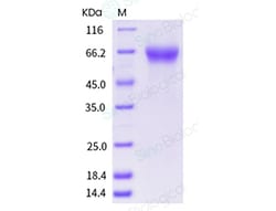 Sino Biological Recombinant Human Angiopoietin-2/ANGPT2 Protein (His Tag),