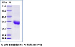 Sino Biological Recombinant Human ULBP1/NKG2DL1 Protein (His & AVI Tag),