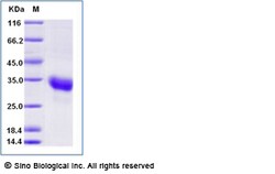 Sino Biological Recombinant Human ULBP1/NKG2DL1 Protein (His & AVI Tag),