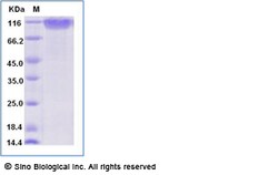 Sino Biological Recombinant Human NCAM-1/CD56 Protein (ECD, His & AVI Tag),