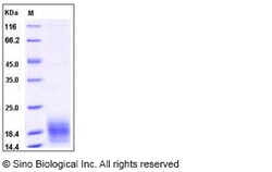 Sino Biological Recombinant Human Lymphotactin/XCL1/SCYC1 Protein (His
