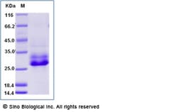 Sino Biological Recombinant Human Syndecan-4 Protein (His Tag), Quantity: