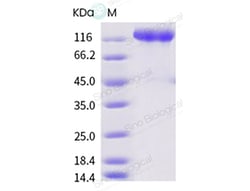 Sino Biological Recombinant Human LIFR Protein (His Tag), Amine-Labeled