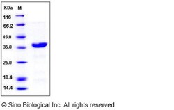 Sino Biological Recombinant Human EMAPII/AIMP1 Protein (His Tag), Quantity: