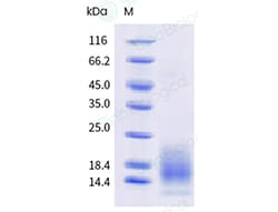 Sino Biological Recombinant Human BCMA Protein (ECD, His & AVI Tag), Biotinylated,