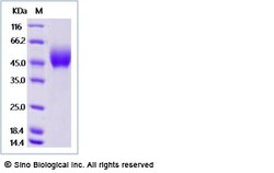 Sino Biological Recombinant Human FGFR1 Protein (His Tag), Amine-Labeled