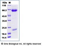 Sino Biological Human PCSK9 / NARC1 (D374Y, V474I, G670E) Protein (His