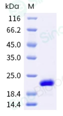 Sino Biological Recombinant Human FGF-10 Protein, HPLC-verified, Quantity: