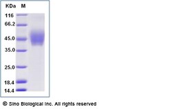 Sino Biological Recombinant Human DNAM-1/CD226 Protein (ECD, His Tag),