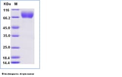 Sino Biological Recombinant Human DNAM-1/CD226 Protein (ECD, hFc Tag),