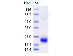 Sino Biological Recombinant Human VEGF-D Protein (His Tag), Quantity: Each