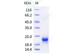 Sino Biological Recombinant Human VEGF-C Protein (His Tag), Quantity: Each