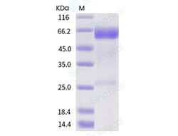 Sino Biological Recombinant Human FGFR4 Protein (His Tag), Amine-Labeled