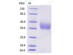 Sino Biological Recombinant Human TREM-1 Protein (ECD, His Tag), HPLC-verified,