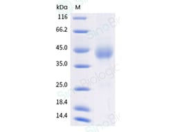 Sino Biological Recombinant Human OX40/TNFRSF4 Protein (ECD, His Tag),