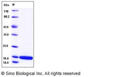 Sino Biological Recombinant Human CCL21/6Ckine Protein, Quantity: Each