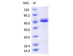 Sino Biological Recombinant Human DR5/TRAIL R2 Protein (ECD, hFc Tag),