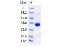 Sino Biological Recombinant Human Oncostatin M/OSM Protein (His & AVI Tag),