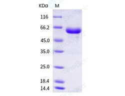 Sino Biological Recombinant Human ARSA Protein (His Tag), Quantity: Each