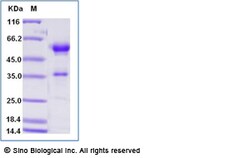 Sino Biological Recombinant Human BMPR1A/ALK-3 Protein (ECD, hFc Tag),