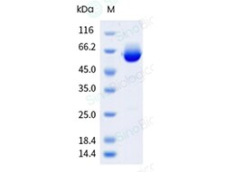 Sino Biological Recombinant Human Alkaline Phosphatase/ALPL Protein (His