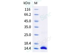 Sino Biological Recombinant Human, Mouse, Rat, Rhesus, Canine BMP-2 Protein,
