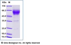 Sino Biological Recombinant Human DcR2/TRAIL R4 Protein (ECD, hFc Tag),