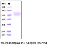 Sino Biological Recombinant Human Kallikrein 1 Protein (His Tag), HPLC-verified,