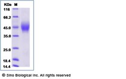 Sino Biological Recombinant Human IL-4R Protein (His Tag), Amine-Labeled