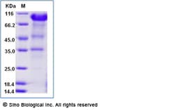 Sino Biological Recombinant Human IL-6R Protein (ECD, AVI & Fc Tag), Biotinylated,