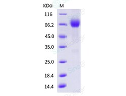 Sino Biological Recombinant Human IL-6R Protein (ECD, His Tag), HPLC-verified,
