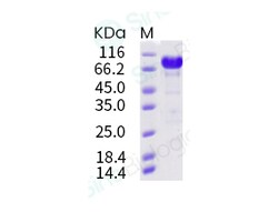 Sino Biological Recombinant Human IL-6R Protein (ECD, hFc Tag), Quantity: