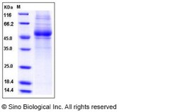Sino Biological Recombinant Human IL-5R alpha Protein (His Tag), Quantity: