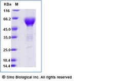 Sino Biological Recombinant Human TIM-3/HAVCR2 Protein (mFc Tag), ECD,